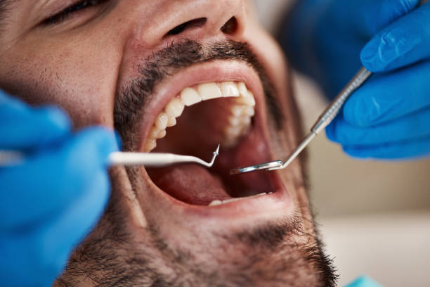 Best Root Canal Treatment  in Cera, AL